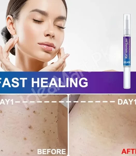 skin-tag-mole-remover-pen-remove-warts-pimples-black-dots-safely-for-women-product-image