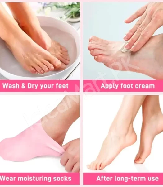 anti-heel-crack-silicone-socks-for-moisturizing-product-image