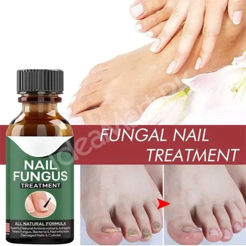 fast-nail-fungal-treatments-nail-repair-essences-serum-care-treatments-foot-nail-fungus-removal-gel-paronychia-product-image