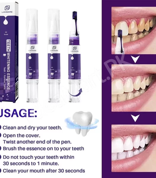 v34-teeth-whitening-pen-purple-color-correcting-formula-for-stain-removal-tartar-cleaning-bright-smile-4ml-product-image