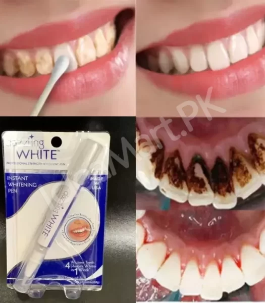 teeth-whitening-pen-instant-gel-pen-for-removing-stains-spots-yellow-teeth-oral-care-whitening-product-image