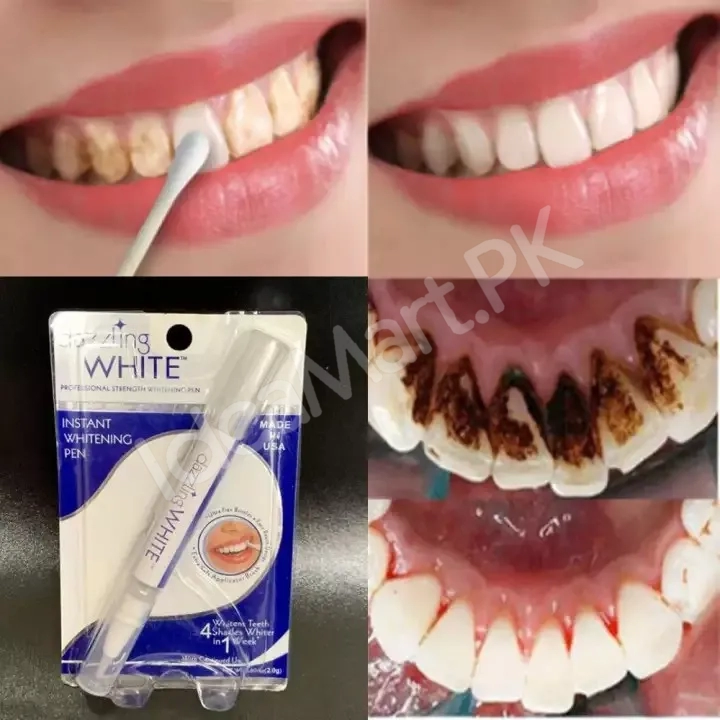 teeth-whitening-pen-instant-gel-pen-for-removing-stains-spots-yellow-teeth-oral-care-whitening-product-image