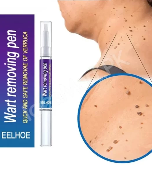 skin-tag-mole-remover-pen-remove-warts-pimples-black-dots-safely-for-women-product-image
