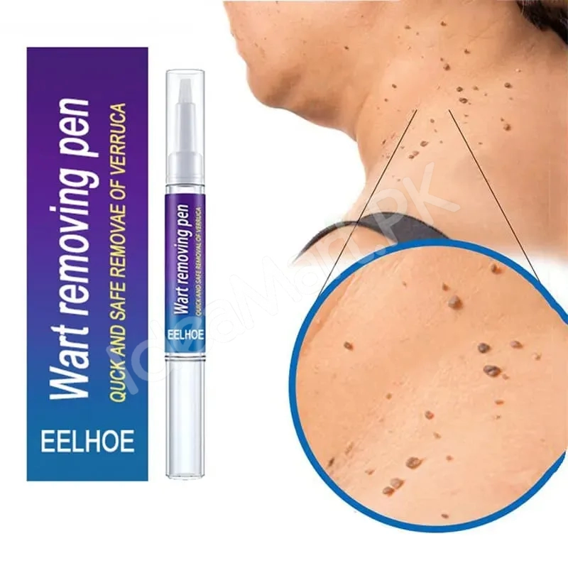 skin-tag-mole-remover-pen-remove-warts-pimples-black-dots-safely-for-women-product-image