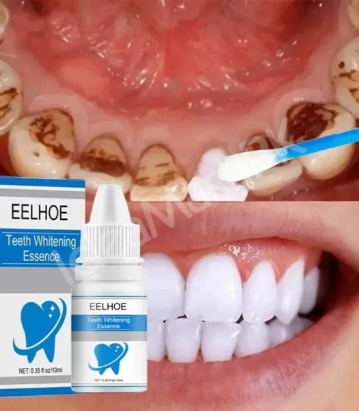 teeth-cleaning-essence-liquid-10ml-natural-whitening-plaque-stain-remover-fresh-breath-daily-oral-hygiene-product-image